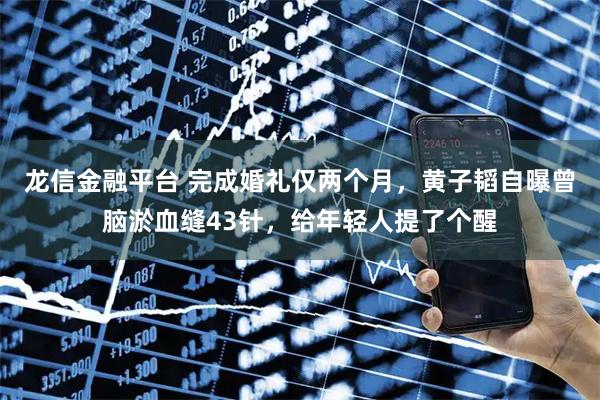 龙信金融平台 完成婚礼仅两个月，黄子韬自曝曾脑淤血缝43针，给年轻人提了个醒